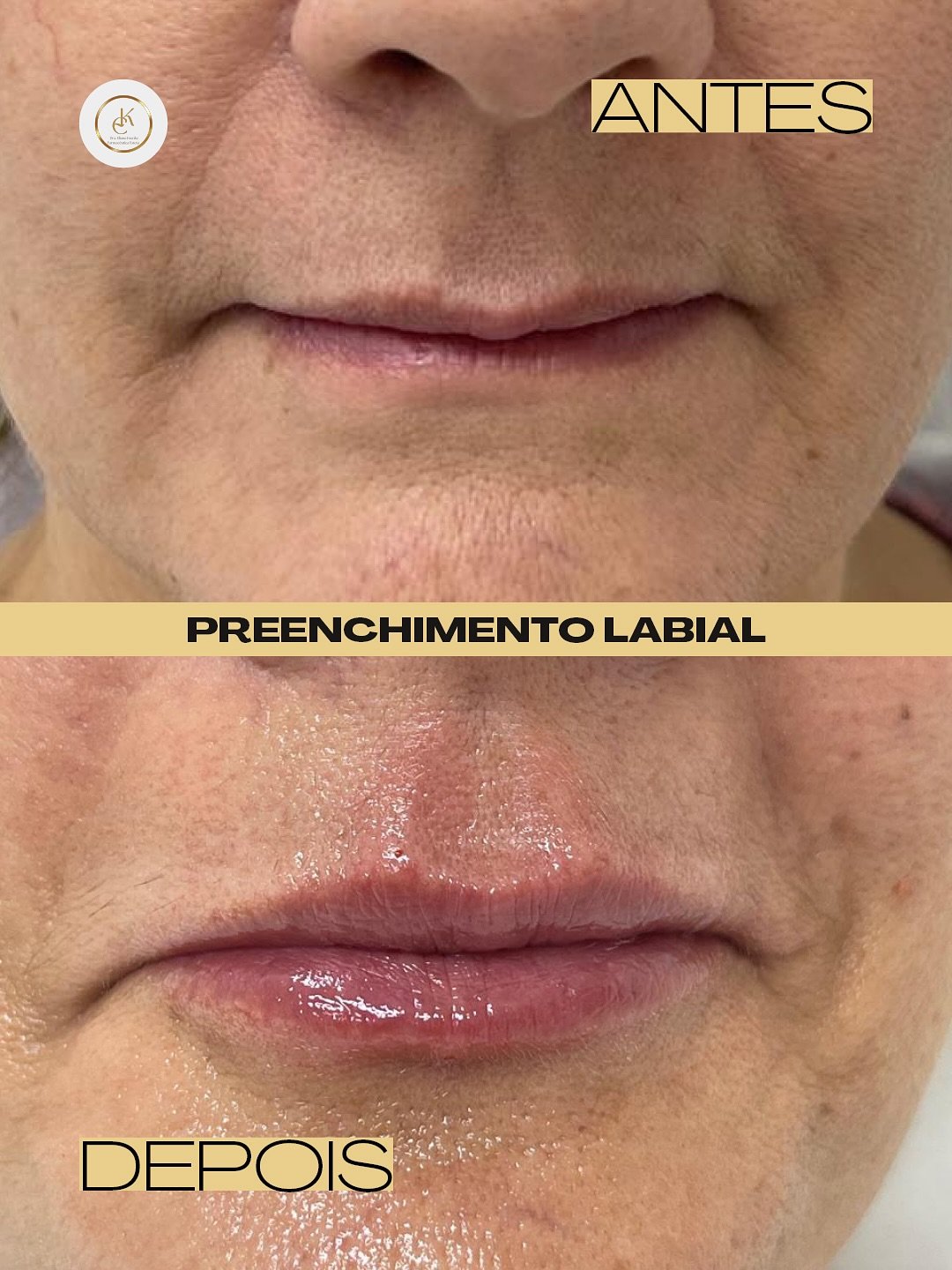 SnapInsta.to_508650799_17979949334849914_1809952970242571013_n